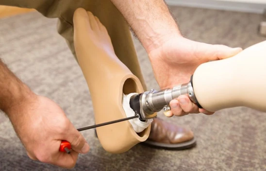 Hatay'da bacağını kaybeden kıza protez takıldı!